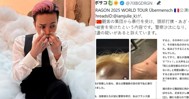 GD巴黎演唱會爆流血衝突！韓妹慘遭中國粉圍毆　螢光棒砸臉還惡人先告狀