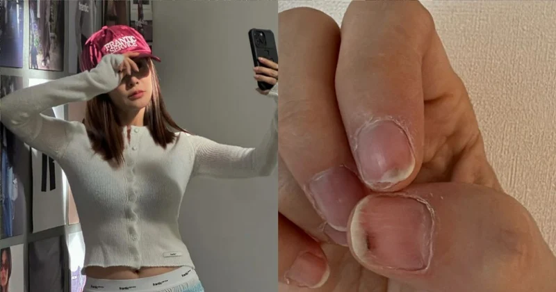韓女星頻繁做美甲裂到爆血！網友炸鍋批：男人從來不用這樣