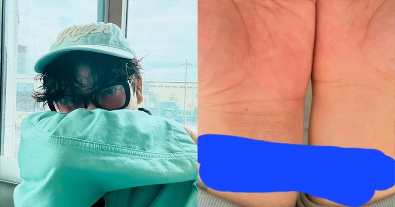 韓男星爭議不斷突PO「手腕血痕」輕生照！卻遭撻伐：完全沒在反省