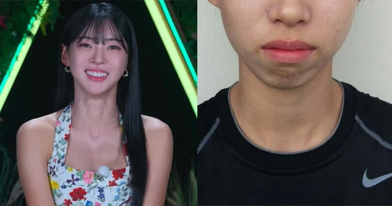 《單身即地獄5》「小Karina」學生時期舊照被挖！網驚：差好多