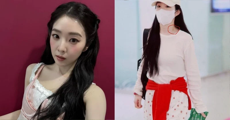 Irene機場照被抓包脖子有紫痕！遭網瘋猜吻痕 本人親自回應了