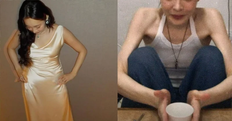 暴瘦到剩骨頭！人氣女星鎖骨凸到嚇人 嚇壞網：認不出來了